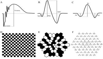 The origins of the full-field flash electroretinogram b-wave